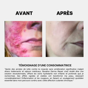 Rexaline Derma Repair Cream - image 2