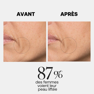 Rexaline Line Killer Lift Serum - image 2