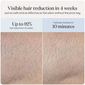 SmoothSkin Pure Mini Lite IPL - image 6