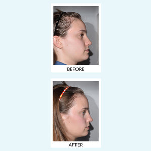 Talika Hair Force Phyto-Serum for thinning hair - image 3