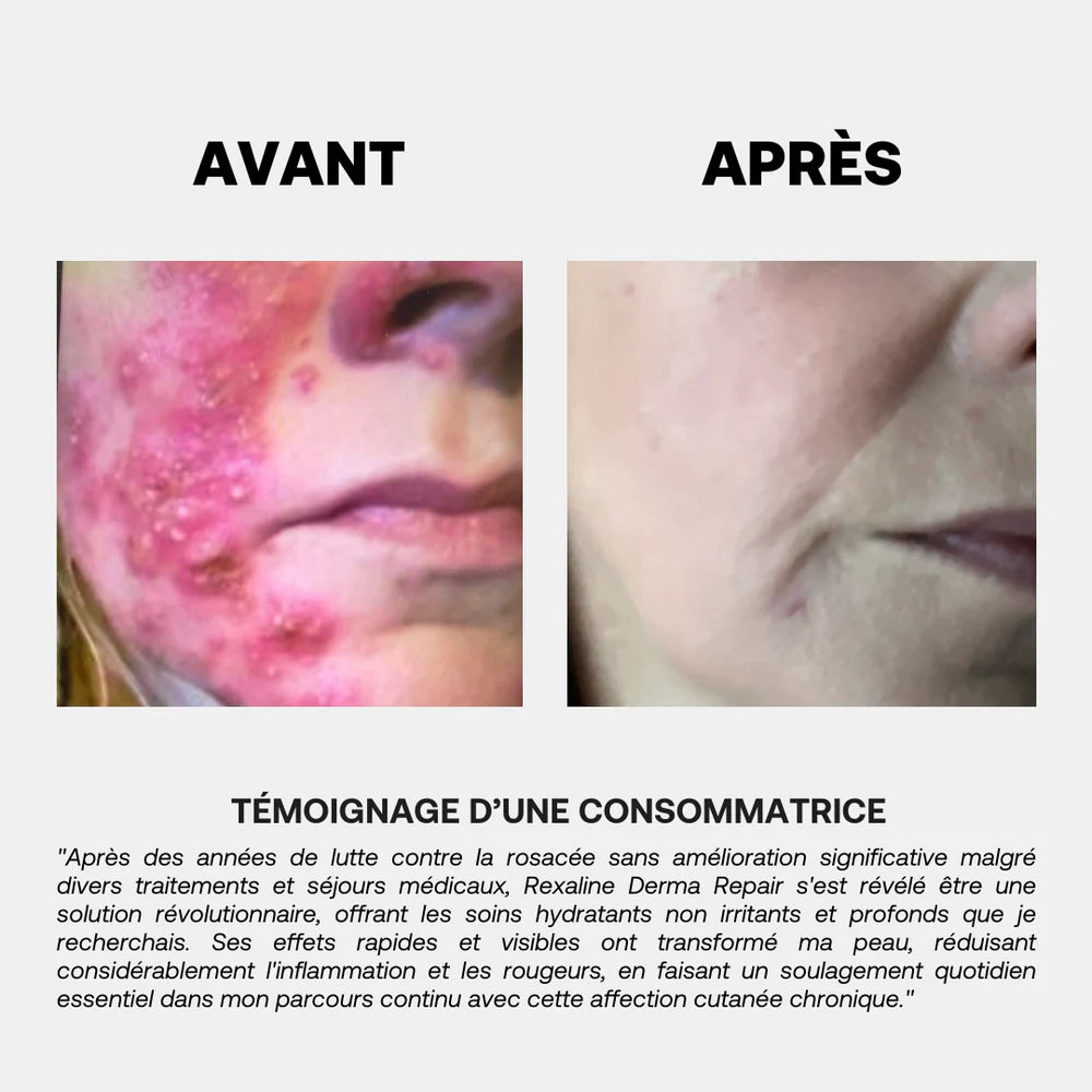Rexaline Derma Repair Cream - image 2