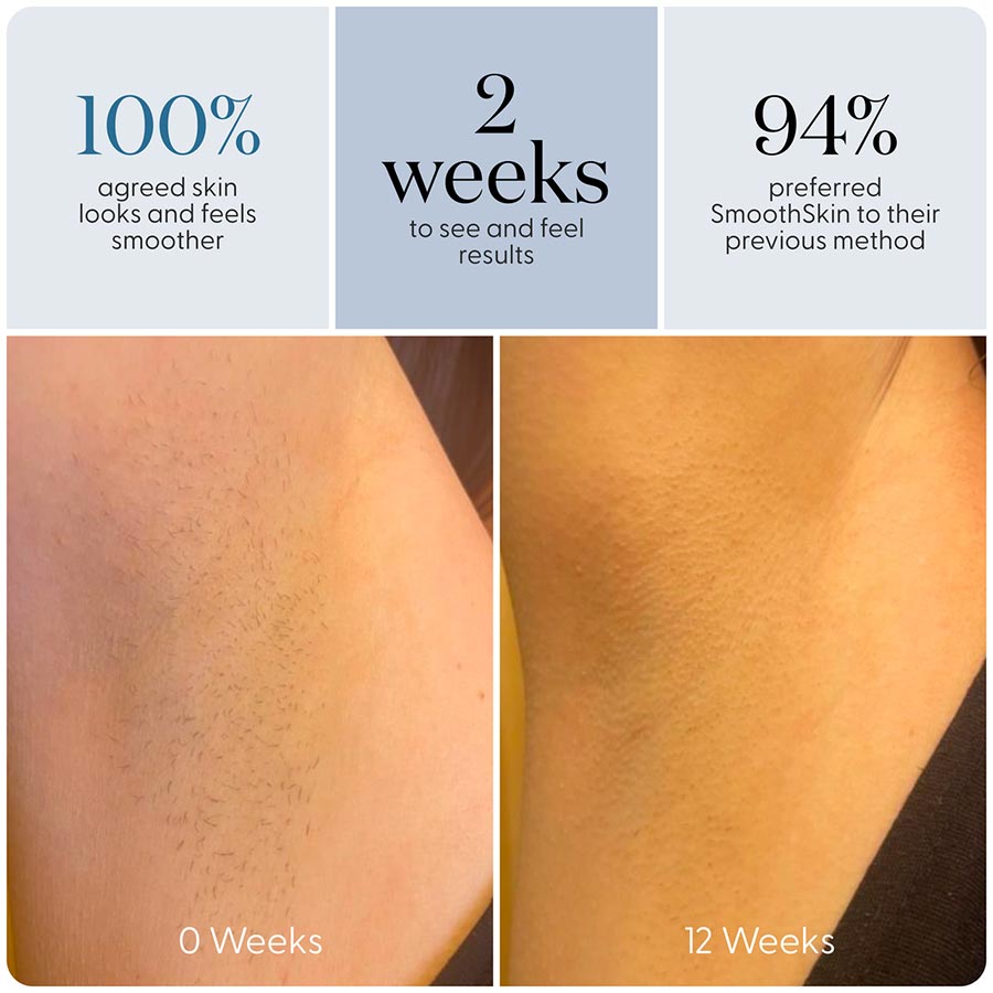 SmoothSkin Pure Adapt IPL hair removal - image 4