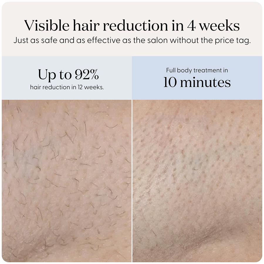 SmoothSkin Pure Mini Lite IPL - image 6