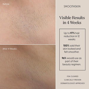 SmoothSkin Pure Mini IPL - image 4