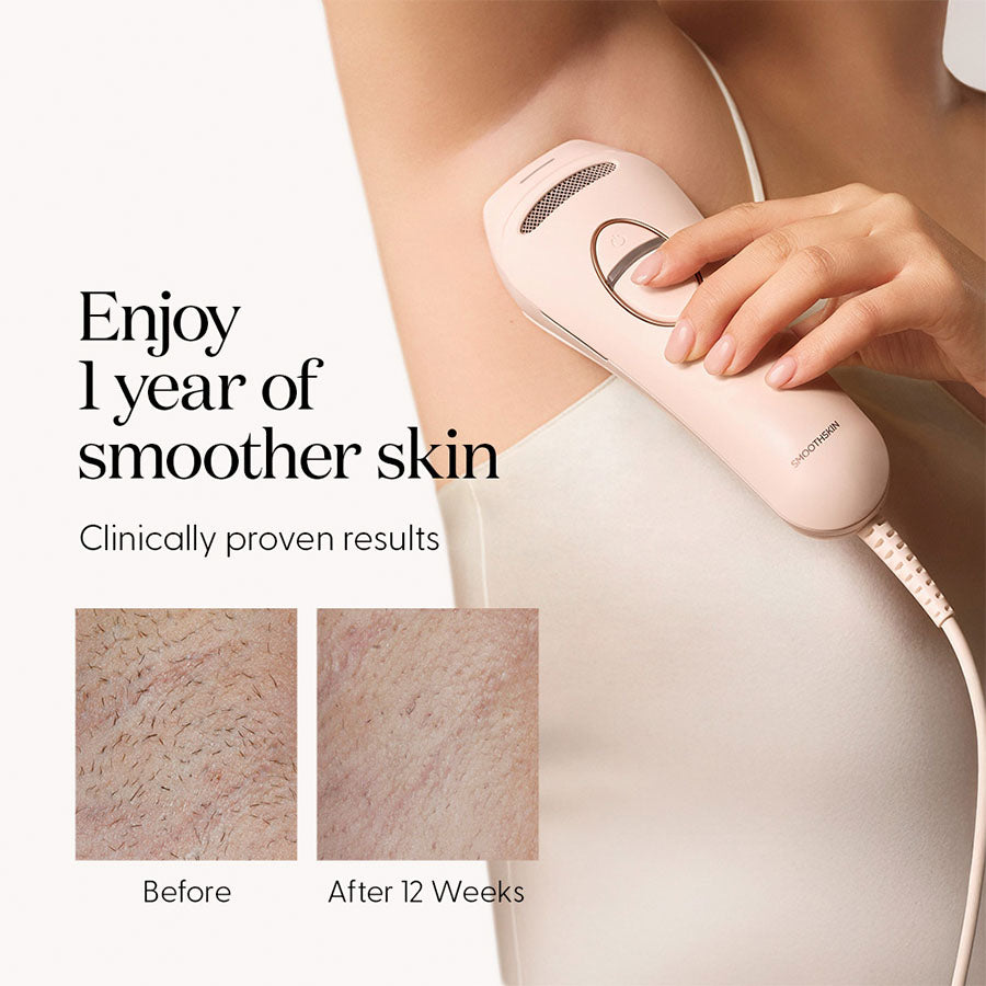 SmoothSkin Pure Switch IPL hair removal - image 4