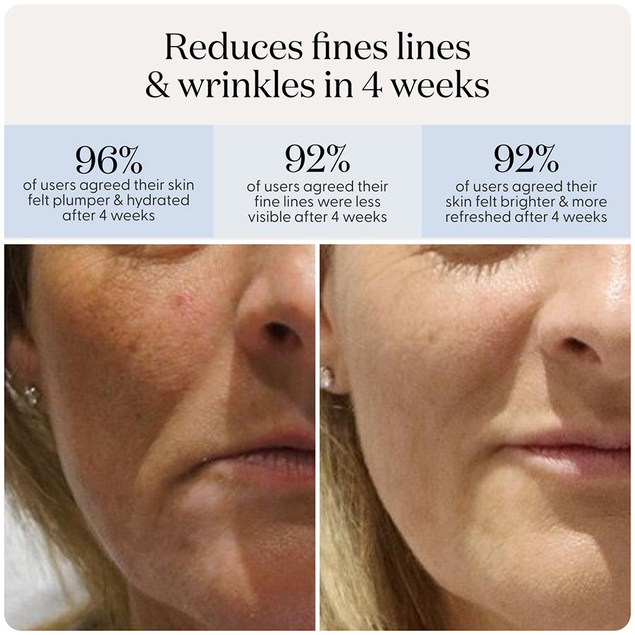 SmoothSkin Red light therapy LED Mask