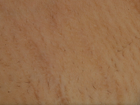 image comparison after